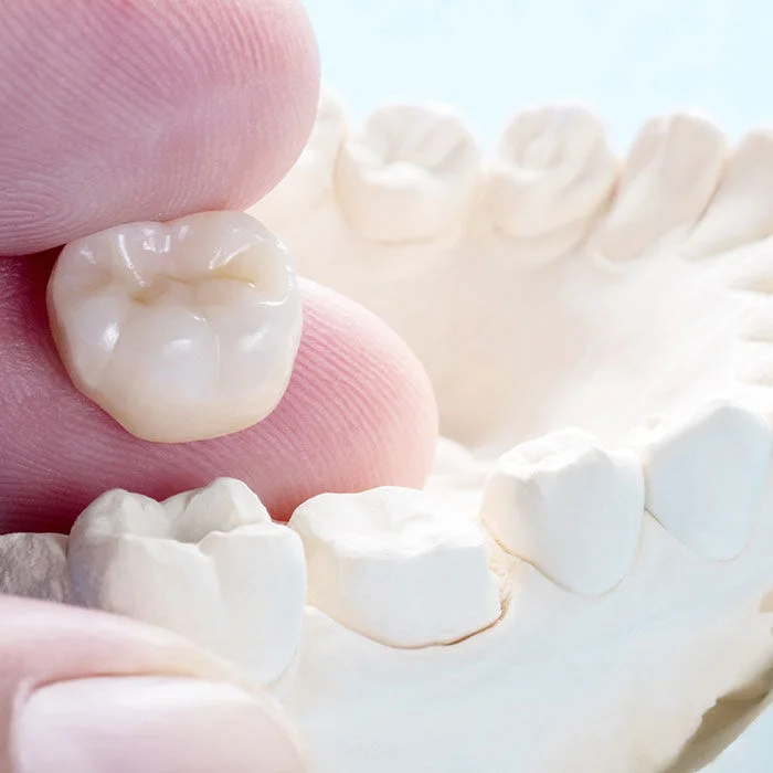 Same-day dental crown procedure at Reform Dentistry Fredericksburg VA